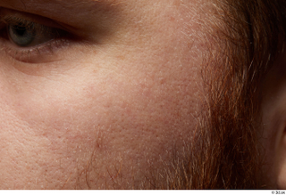  HD Face skin Michael Summers cheek face sin texture skin pores wrinkles 0001.jpg